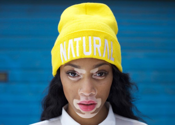 Winnie Harlow: le mannequin qui redéfinit nos critères de beauté