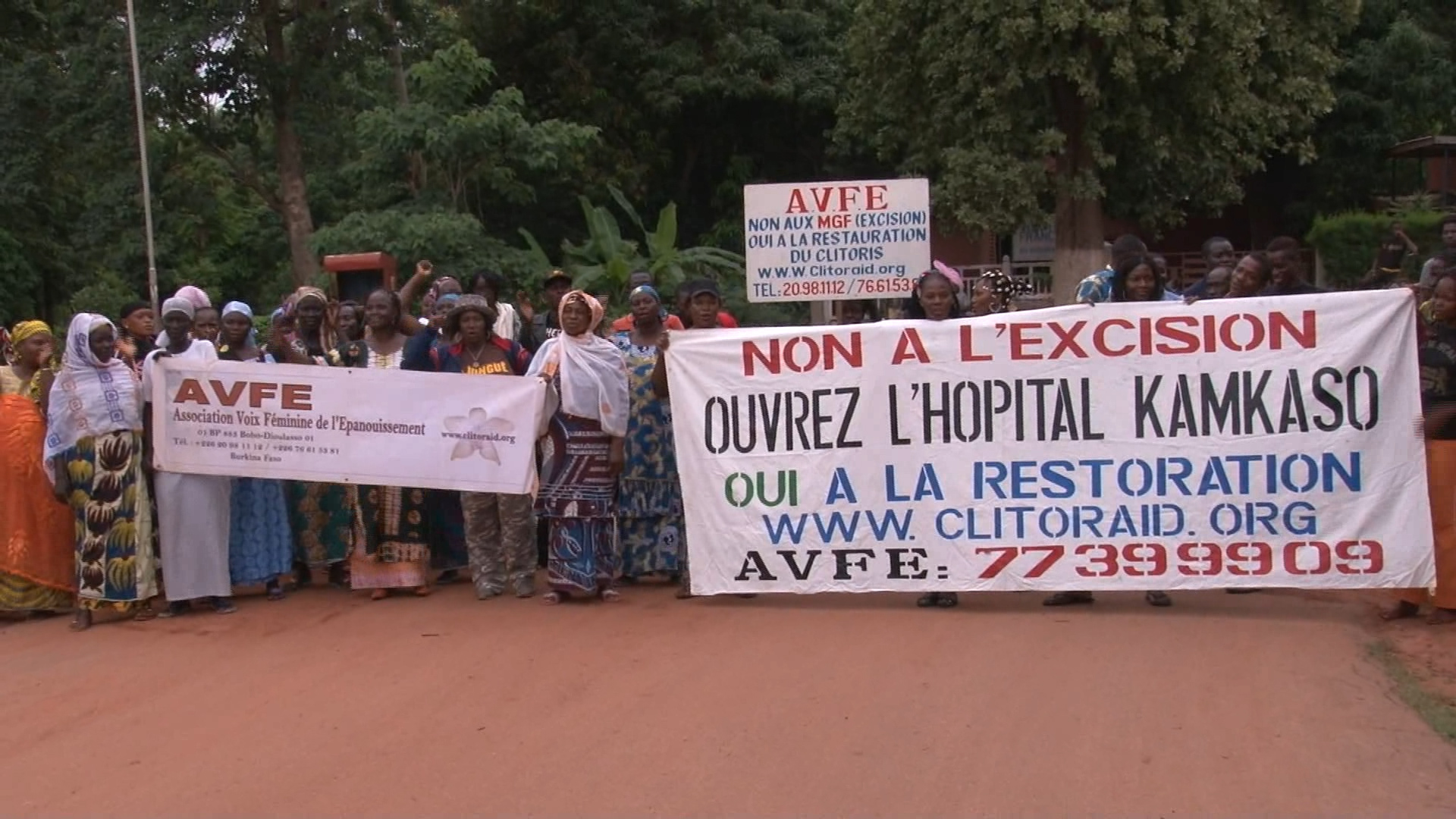 Burkina Faso: une cinquantaine de fillettes excisées sont à l’hôpital