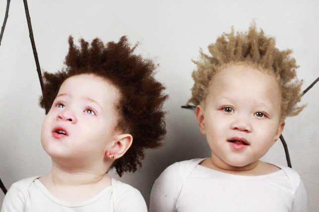 Un couple fatigué qu’on lui demande si ses jumeaux albinos sont à lui