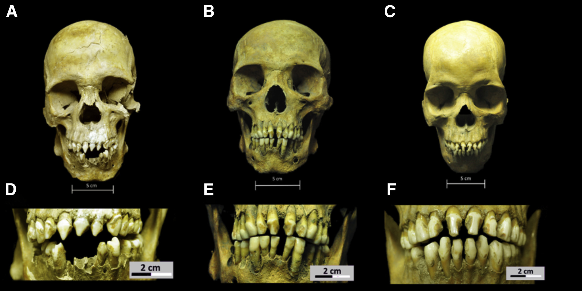 3 squelettes africains d’il y a 500 ans éclairent la présence noire au Mexique