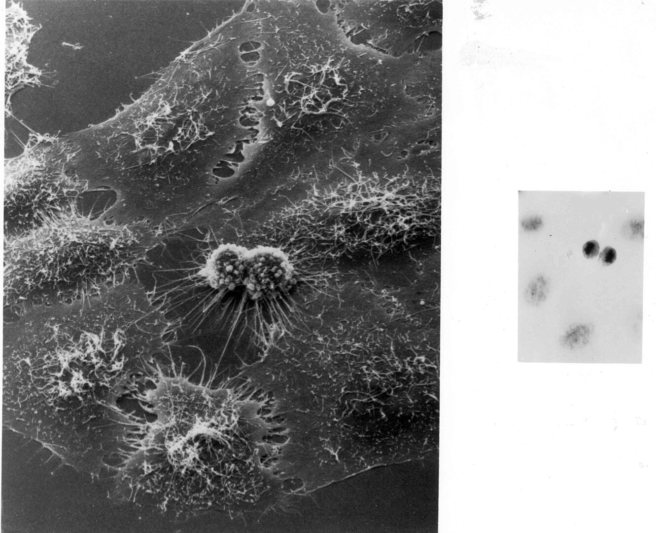 Henrietta Lacks, le secret le plus dérangeant de la médecine moderne