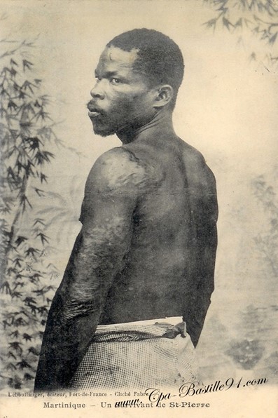 Saint-Pierre, 1902 : la colère de la montagne Pelée